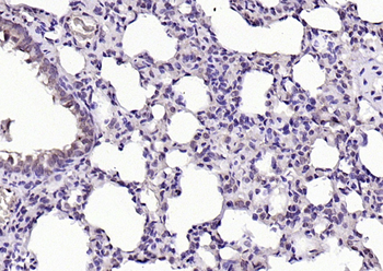 Phospho-Lyn (Tyr507) Rabbit Polyclonal Antibody