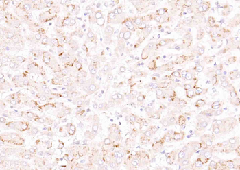 Phospho-IFNAR1 (Ser535+Ser539) Rabbit Polyclonal Antibody