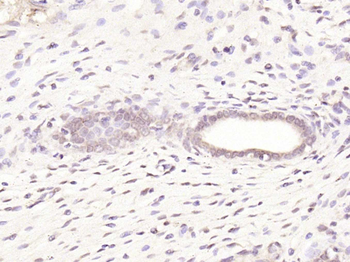 Estrogen Receptor alpha Rabbit Polyclonal Antibody