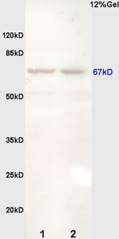Estrogen Receptor alpha Rabbit Polyclonal Antibody