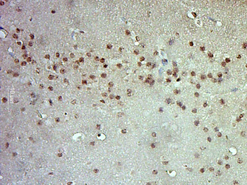 ERK1 + ERK2 Rabbit Polyclonal Antibody