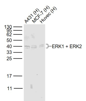 ERK1 + ERK2 Rabbit Polyclonal Antibody