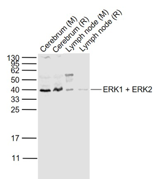 ERK1 + ERK2 Rabbit Polyclonal Antibody
