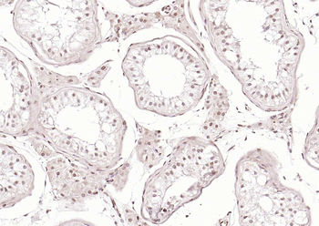 ERCC1 Rabbit Polyclonal Antibody