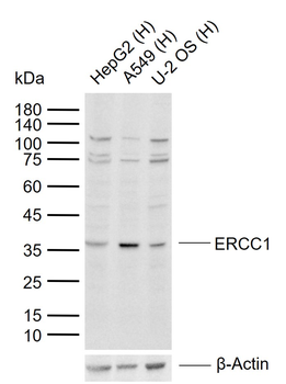 ERCC1 Rabbit Polyclonal Antibody