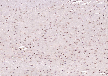 ERCC1 Rabbit Polyclonal Antibody