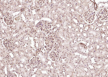ERCC1 Rabbit Polyclonal Antibody