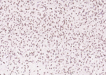 ERCC1 Rabbit Polyclonal Antibody