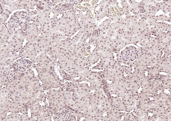 ERCC1 Rabbit Polyclonal Antibody