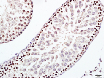 ERCC1 Rabbit Polyclonal Antibody