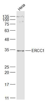 ERCC1 Rabbit Polyclonal Antibody