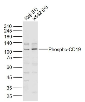 Phospho-CD19 (Tyr531) Rabbit Polyclonal Antibody