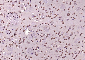 Phospho-Erk1 (Thr202 + Tyr204) Rabbit Polyclonal Antibody