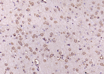 Phospho-Erk1 (Thr202 + Tyr204) Rabbit Polyclonal Antibody