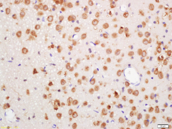 Phospho-Erk1 (Thr202 + Tyr204) Rabbit Polyclonal Antibody