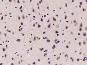 Phospho-p70 S6 Kinase Beta 2 (Tyr389) Rabbit Polyclonal Antibody