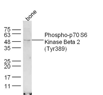 Phospho-p70 S6 Kinase Beta 2 (Tyr389) Rabbit Polyclonal Antibody