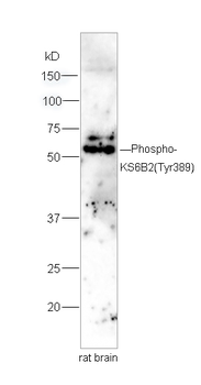 Phospho-p70 S6 Kinase Beta 2 (Tyr389) Rabbit Polyclonal Antibody