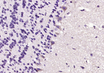 ERK1 Rabbit Polyclonal Antibody