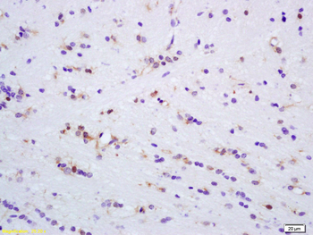 MAPK4 Rabbit Polyclonal Antibody