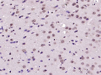 Phospho-IRS1 (Ser1101) Rabbit Polyclonal Antibody