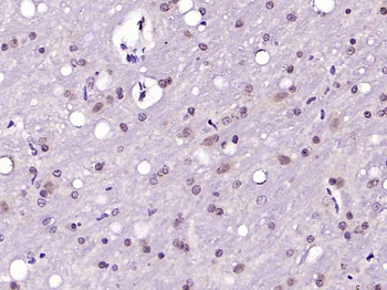 Phospho-IRS1 (Ser1101) Rabbit Polyclonal Antibody