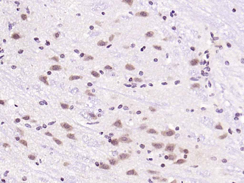 Phospho-IRS1 (Ser1101) Rabbit Polyclonal Antibody