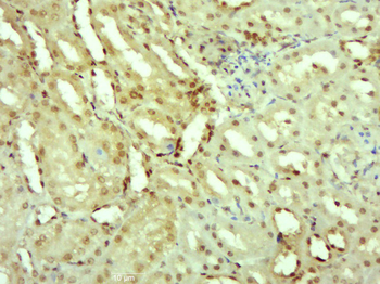 Phospho-IRS1 (Ser1101) Rabbit Polyclonal Antibody