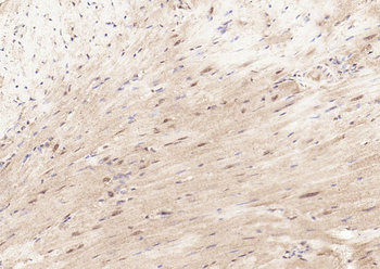 Phospho-STAT3 (Tyr705) Rabbit Polyclonal Antibody