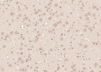 Phospho-STAT3 (Tyr705) Rabbit Polyclonal Antibody
