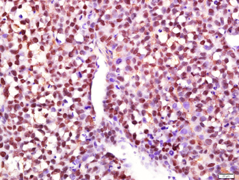 Phospho-STAT3 (Tyr705) Rabbit Polyclonal Antibody