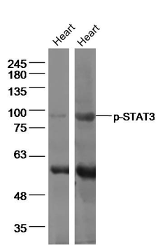 Phospho-STAT3 (Tyr705) Rabbit Polyclonal Antibody