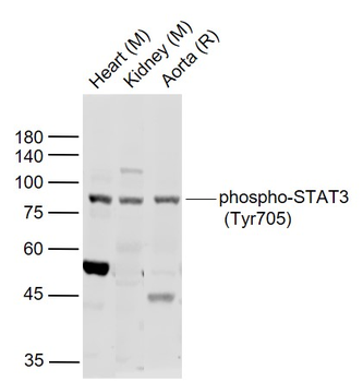 Phospho-STAT3 (Tyr705) Rabbit Polyclonal Antibody