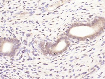 Estrogen Receptor alpha + beta Rabbit Polyclonal Antibody