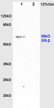 Estrogen Receptor alpha + beta Rabbit Polyclonal Antibody