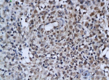 Estrogen Receptor alpha + beta Rabbit Polyclonal Antibody