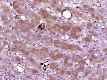 Phospho-Syk (Tyr525 + Tyr526) Rabbit Polyclonal Antibody