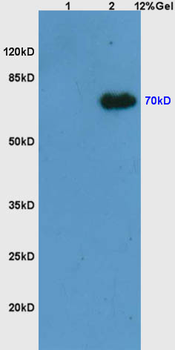 Phospho-Syk (Tyr525 + Tyr526) Rabbit Polyclonal Antibody