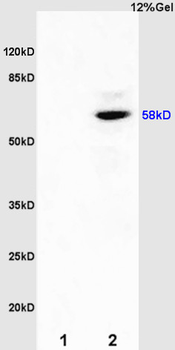 Estrogen receptor beta Rabbit Polyclonal Antibody
