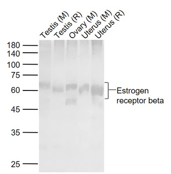 Estrogen receptor beta Rabbit Polyclonal Antibody