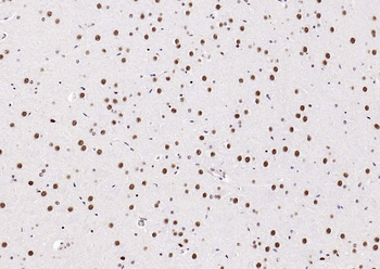 Estrogen receptor beta Rabbit Polyclonal Antibody