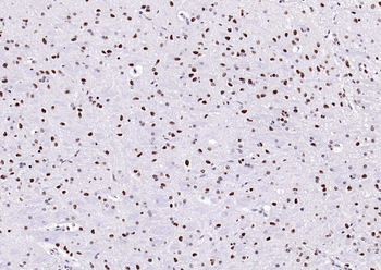 Estrogen receptor beta Rabbit Polyclonal Antibody
