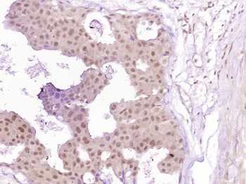 Phospho-Smad3 (Ser213) Rabbit Polyclonal Antibody