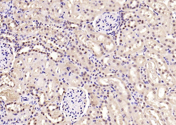 Phospho-Smad3 (Ser213) Rabbit Polyclonal Antibody