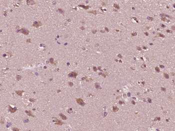 Phospho-HSF1 (Ser303) Rabbit Polyclonal Antibody