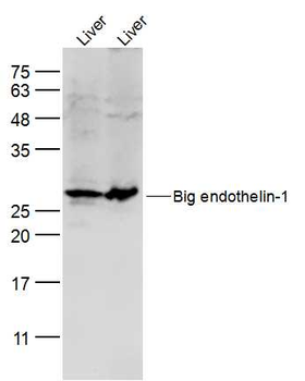 Big endothelin-1 Rabbit Polyclonal Antibody