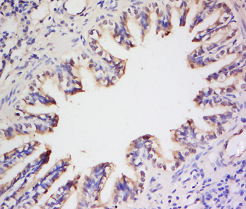 Big endothelin-1 Rabbit Polyclonal Antibody