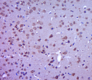 Phospho-FAK (Tyr397) Rabbit Polyclonal Antibody