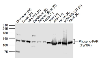 Phospho-FAK (Tyr397) Rabbit Polyclonal Antibody