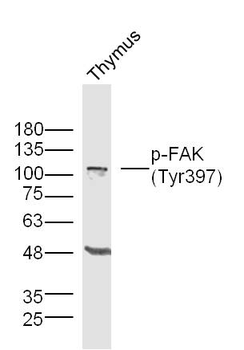 Phospho-FAK (Tyr397) Rabbit Polyclonal Antibody